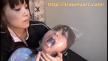 Extasis anormal